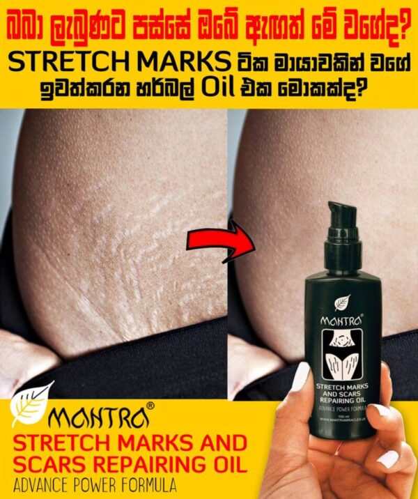 Stretch Marks & Scars Repairing Oil